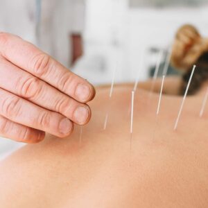 Acupuncture Diploma Program