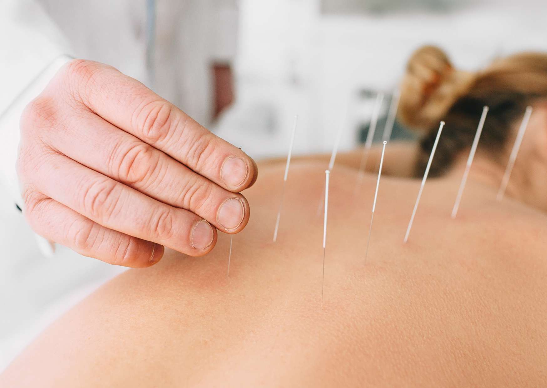 Acupuncture Diploma Program